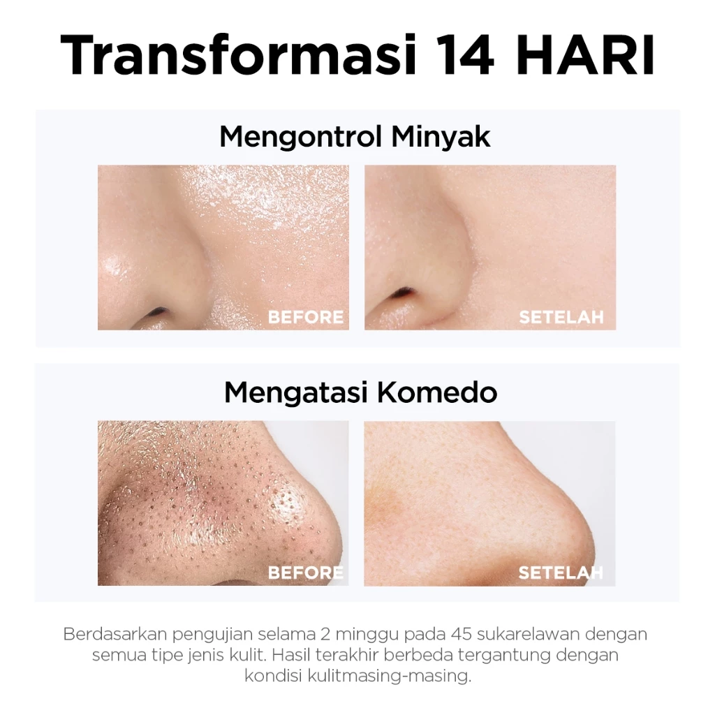 sabun_cuci_muka.jpg sabun_cuci_muka_pria.jpg sabun_cuci_muka_acnes.jpg sabun_cuci_muka_untuk kulit_berminyak.jpg