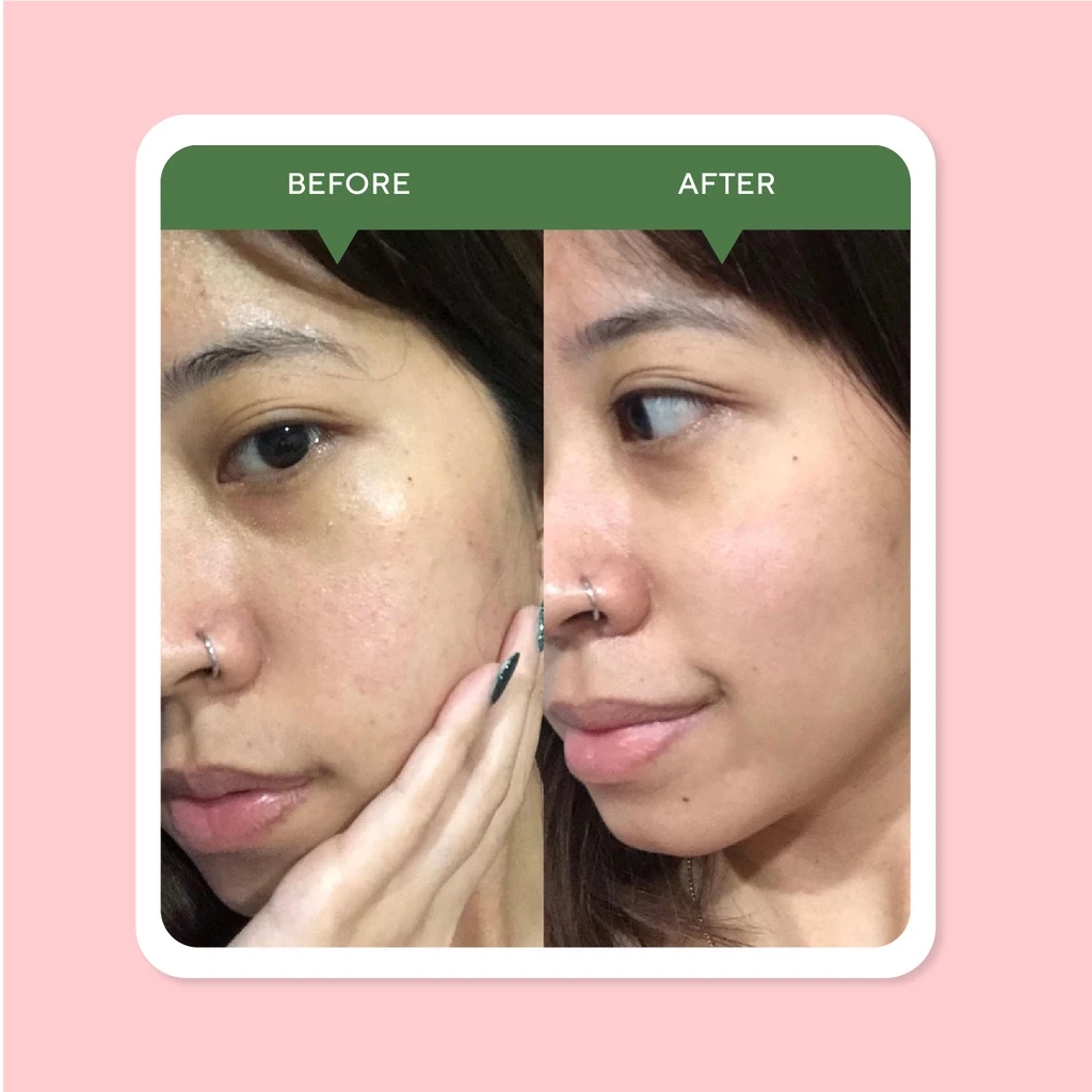 sabun_cuci_muka.jpg sabun_cuci_muka_pria.jpg sabun_cuci_muka_acnes.jpg sabun_cuci_muka_untuk kulit_berminyak.jpg